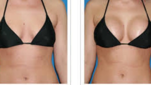 BREAST ENLARGEMENT OR ENHANCEMENT +27605775963 CREAM AND PILLS